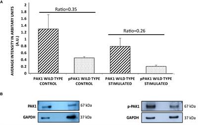 The Role of PAK1 in the Maturation of Invadopodia During Transient Mechanical Stimulation